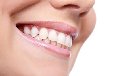 Sonrisa sana