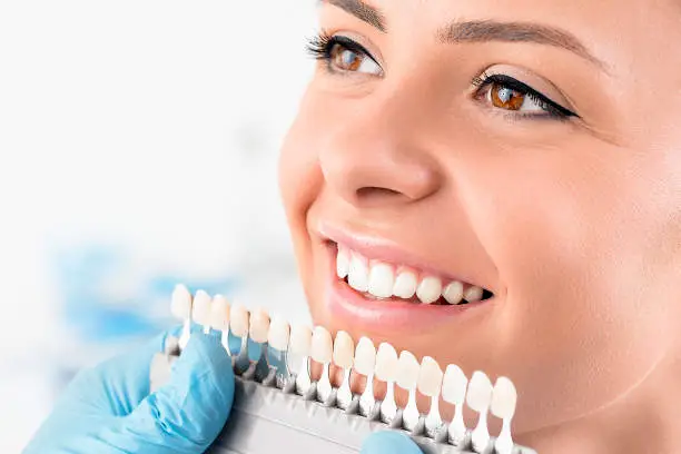 Muestras de blanqueamiento dental