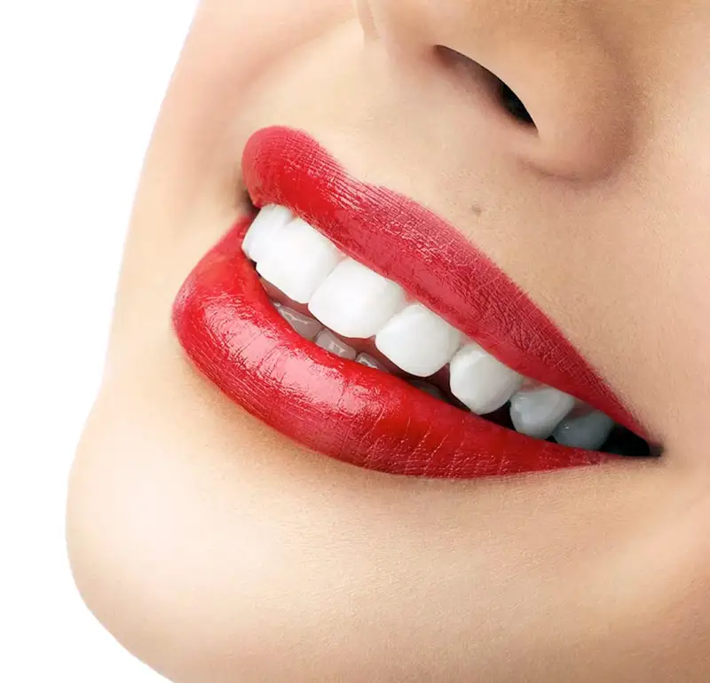 Blanqueamiento Dental En Clínica